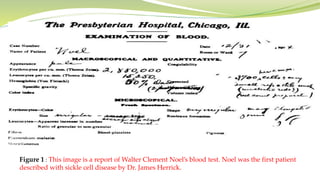 Figure 1 : This image is a report of Walter Clement Noel’s blood test. Noel was the first patient
described with sickle cell disease by Dr. James Herrick.
 