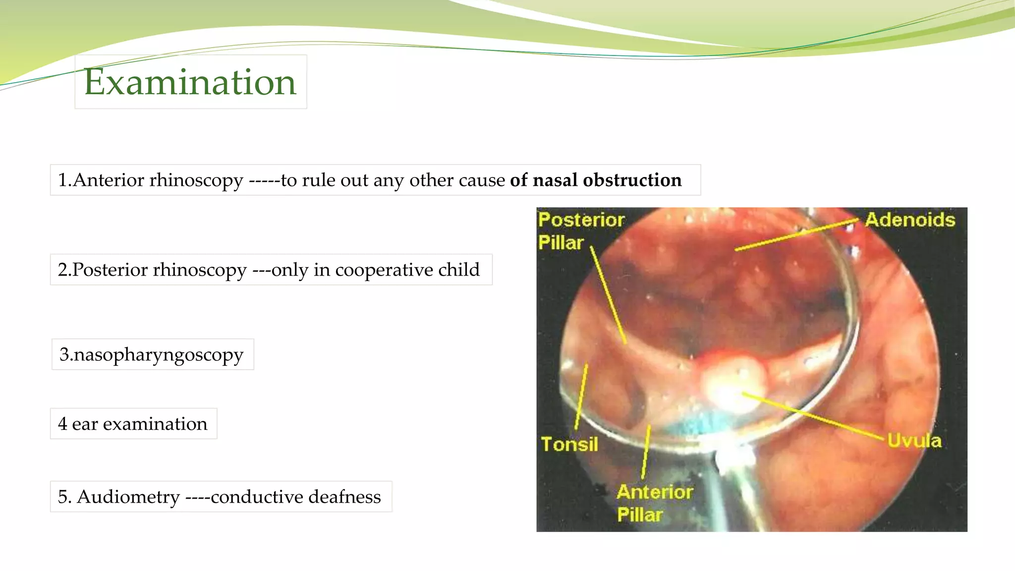 Examination
1.Anterior rhinoscopy -----to rule out any other cause of nasal obstruction
2.Posterior rhinoscopy ---only in cooperative child
3.nasopharyngoscopy
4 ear examination
5. Audiometry ----conductive deafness
 