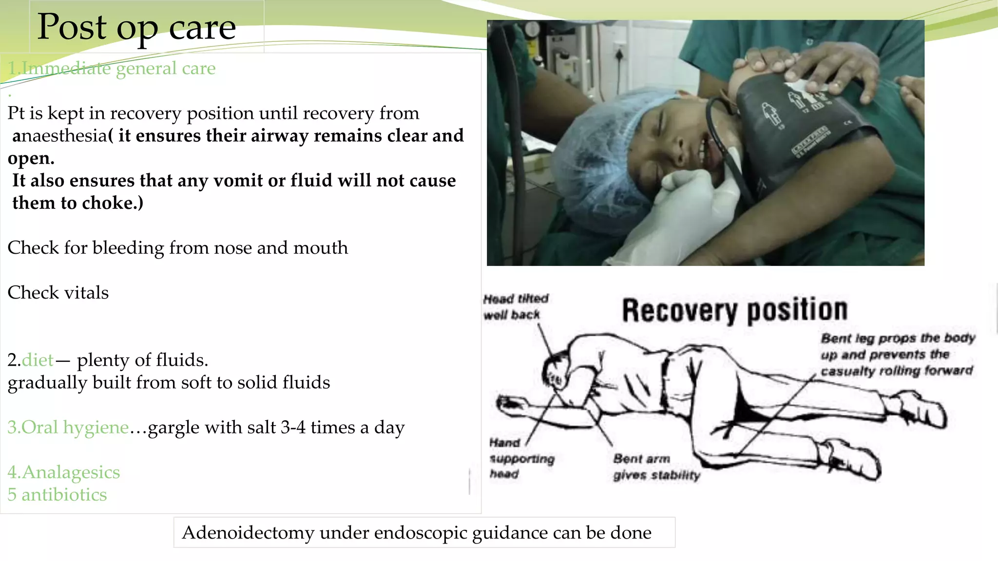 Post op care
1.Immediate general care
.
Pt is kept in recovery position until recovery from
anaesthesia( it ensures their airway remains clear and
open.
It also ensures that any vomit or fluid will not cause
them to choke.)
Check for bleeding from nose and mouth
Check vitals
2.diet— plenty of fluids.
gradually built from soft to solid fluids
3.Oral hygiene…gargle with salt 3-4 times a day
4.Analagesics
5 antibiotics
Adenoidectomy under endoscopic guidance can be done
 