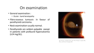 On examination
• General examination :
• Ocular : band keratopathy
• Fibro-osseous tumours- in favour of
parathyroid carcinoma.
• Neck examination-usually normal.
• Parathyroids are seldom palpable except
in patients with profound hypercalcemia
(≥14 mg/dL).
By Thomas J. Stokkermans, OD, PhD, Pankaj C. Gupta, MD,
MSc, and Rony R. Sayegh, MD
 