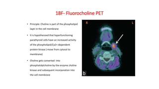 18F- Fluorocholine PET
• Principle: Choline is part of the phospholipid
layer in the cell membrane
• It is hypothesized that hyperfunctioning
parathyroid cells have an increased activity
of the phospholipid/Ca2+-dependent
protein kinase ( move from cytosol to
membrane)
• Choline gets converted into
phosphatidylcholine by the enzyme choline
kinase and subsequent incorporation into
the cell membrane
 