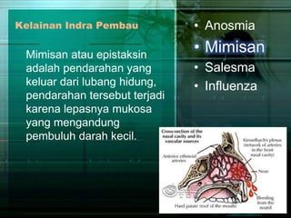 Kelainan Indra Pembau

Mimisan atau epistaksin
adalah pendarahan yang
keluar dari lubang hidung,
pendarahan tersebut terjadi
karena lepasnya mukosa
yang mengandung
pembuluh darah kecil.

• Anosmia

• Mimisan
• Salesma
• Influenza

 