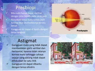Presbiopi









Bila mata hanya dapat melihat
dengan jelas benda pada jarak jauh
Penyebab lensa mata terlalu piph
karena daya akomodasinya terlalu
lemah
Gangguan ini dapat di bantu dengan
lensa rangkap

Astigmat
Gangguan mata yang tidak dapat
membedakan garis vertikal dan
herizontal, karena tidak ratanya
kornea mata sehingga cahaya
sejajar yang datang tidak dapat
difokuskan ke satu titik
Gangguan ini dapat dibantu
dengan lensa silindris

 