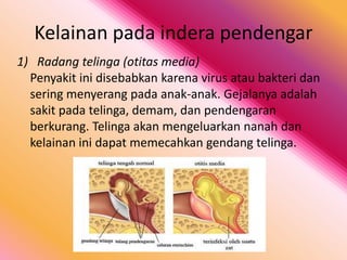 Kelainan pada indera pendengar
1) Radang telinga (otitas media)
Penyakit ini disebabkan karena virus atau bakteri dan
sering menyerang pada anak-anak. Gejalanya adalah
sakit pada telinga, demam, dan pendengaran
berkurang. Telinga akan mengeluarkan nanah dan
kelainan ini dapat memecahkan gendang telinga.

 