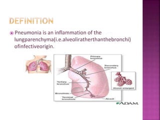 ⦿ Pneumonia is an inflammation of the
lungparenchyma(i.e.alveoliratherthanthebronchi)
ofinfectiveorigin.
 