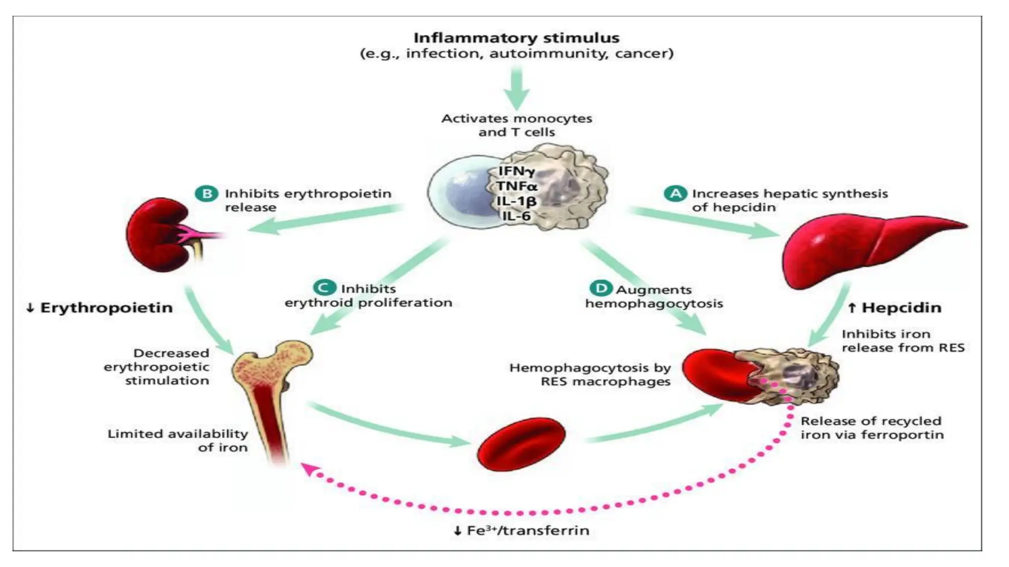 ANEMIA IN CHRONIC KIDNEY DISEASE,NEPHROLOGY | PDF