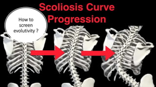 Digitized manual palpation: a new method of evaluating posture and its ...