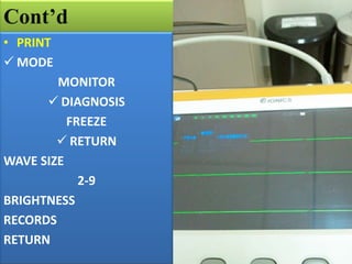 Cont’d
• PRINT
 MODE
MONITOR
 DIAGNOSIS
FREEZE
 RETURN
WAVE SIZE
2-9
BRIGHTNESS
RECORDS
RETURN

 