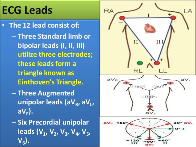 12 Lead Ecg Placement Adinstruments