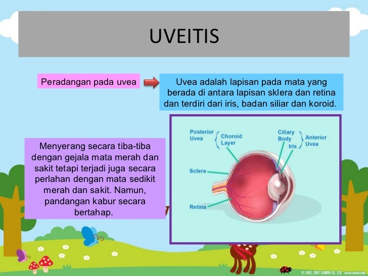 Masalah Penglihatan