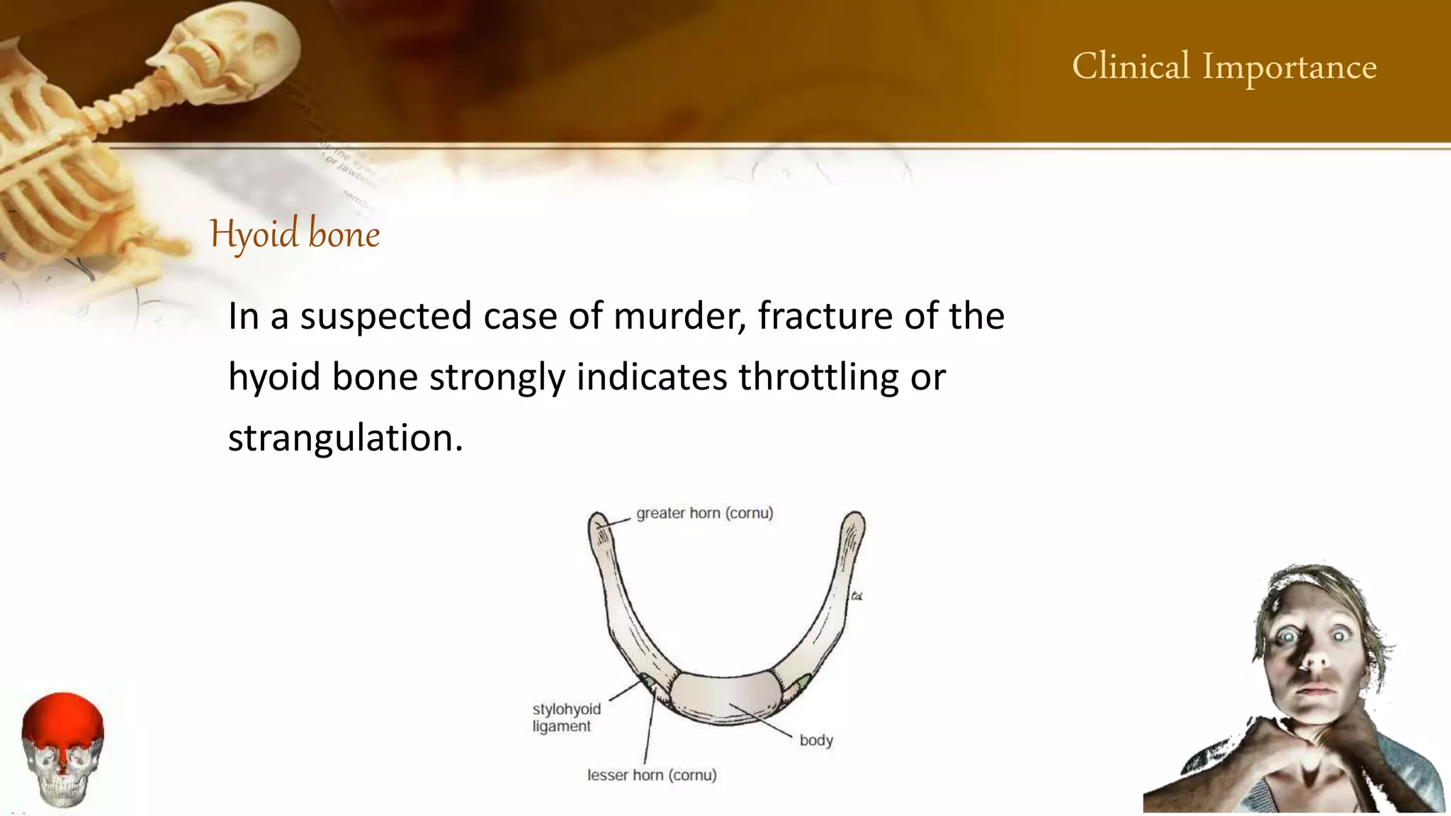 Strangulation Bone Clinical Anatomy of Skull (Presentation by Muhammad Arslan Yasin ...
