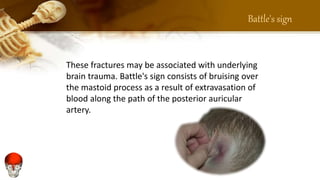 Clinical Anatomy of Skull (Presentation by Muhammad Arslan Yasin ...