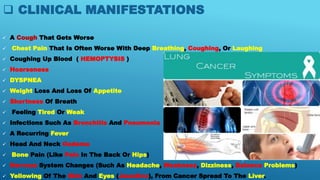  CLINICAL MANIFESTATIONS
 A Cough That Gets Worse
 Chest Pain That Is Often Worse With Deep Breathing, Coughing, Or Laughing
 Coughing Up Blood ( HEMOPTYSIS )
 Hoarseness
 DYSPNEA
 Weight Loss And Loss Of Appetite
 Shortness Of Breath
 Feeling Tired Or Weak
 Infections Such As Bronchitis And Pneumonia
 A Recurring Fever
 Head And Neck Oedema
 Bone Pain (Like Pain In The Back Or Hips)
 Nervous System Changes (Such As Headache, Weakness, Dizziness, Balance Problems)
 Yellowing Of The Skin And Eyes (Jaundice), From Cancer Spread To The Liver.
 