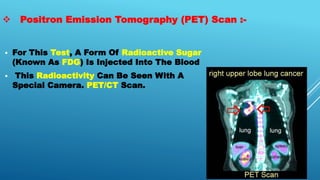  Positron Emission Tomography (PET) Scan :-
 For This Test, A Form Of Radioactive Sugar
(Known As FDG) Is Injected Into The Blood
 This Radioactivity Can Be Seen With A
Special Camera. PET/CT Scan.
 