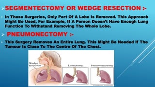 SEGMENTECTOMY OR WEDGE RESECTION :-
 In These Surgeries, Only Part Of A Lobe Is Removed. This Approach
Might Be Used, For Example, If A Person Doesn’t Have Enough Lung
Function To Withstand Removing The Whole Lobe.
 PNEUMONECTOMY :-
 This Surgery Removes An Entire Lung. This Might Be Needed If The
Tumour Is Close To The Centre Of The Chest.
 