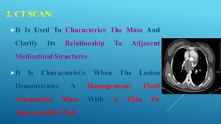 2. CT SCAN:
It Is Used To Characterize The Mass And
Clarify Its Relationship To Adjacent
Mediastinal Structures.
It Is Characteristic When The Lesion
Demonstrates A Homogeneous Fluid
Attenuation Mass With A Thin Or
Imperceptible Wall.
 
