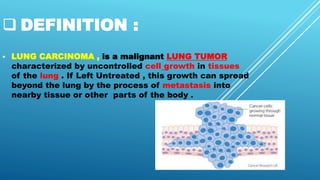  DEFINITION :
 LUNG CARCINOMA , is a malignant LUNG TUMOR
characterized by uncontrolled cell growth in tissues
of the lung . If Left Untreated , this growth can spread
beyond the lung by the process of metastasis into
nearby tissue or other parts of the body .
 