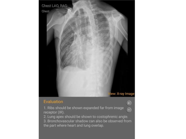 Presentation chest.pptx x ray positioning of chest | PPTX