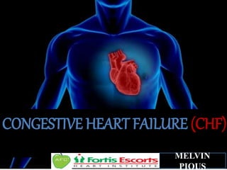 CONGESTIVE HEART FAILURE (CHF)
MELVIN
PIOUS
 