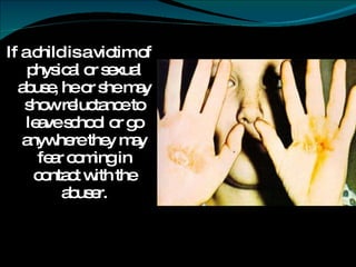 If a child is a victim of physical or sexual abuse, he or she may show reluctance to leave school or go anywhere they may fear coming in contact with the abuser. 