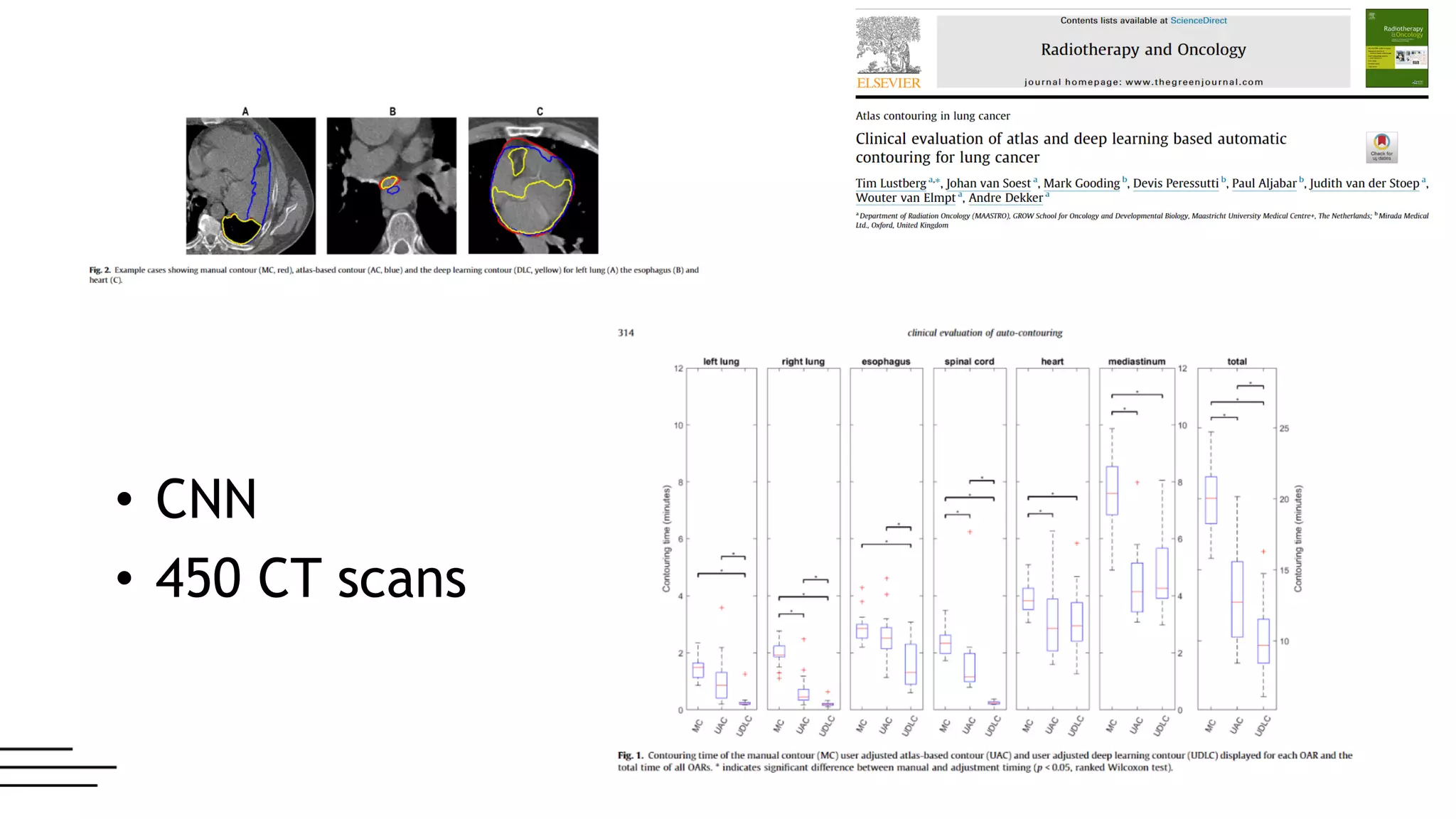 • CNN
• 450 CT scans
 