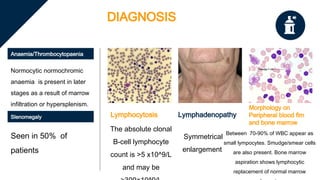 DIAGNOSIS
Lymphocytosis
The absolute clonal
B-cell lymphocyte
count is >5 x10^9/L
and may be
Lymphadenopathy
Symmetrical
enlargement
Morphology on
Peripheral blood fim
and bone marrow
Between 70-90% of WBC appear as
small lympocytes. Smudge/smear cells
are also present. Bone marrow
aspiration shows lymphocytic
replacement of normal marrow
Anaemia/Thrombocytopaenia
Normocytic normochromic
anaemia is present in later
stages as a result of marrow
infiltration or hypersplenism.
Slenomegaly
Seen in 50% of
patients
 