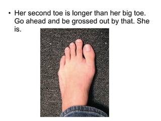 Her second toe is longer than her big toe. Go ahead and be grossed out by that. She is. 