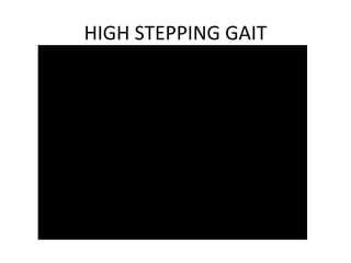 HIGH STEPPING GAIT
 