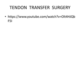 TENDON TRANSFER SURGERY
• https://www.youtube.com/watch?v=Olt4HJQb
F5I
 