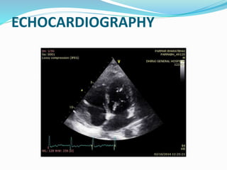 ECHOCARDIOGRAPHY
 