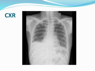 CXR
 