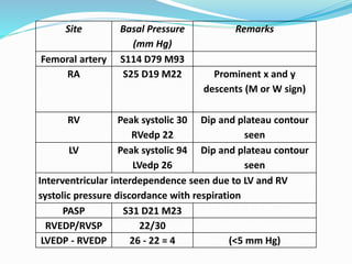 Site Basal Pressure
(mm Hg)
Remarks
Femoral artery S114 D79 M93
RA S25 D19 M22 Prominent x and y
descents (M or W sign)
RV Peak systolic 30
RVedp 22
Dip and plateau contour
seen
LV Peak systolic 94
LVedp 26
Dip and plateau contour
seen
Interventricular interdependence seen due to LV and RV
systolic pressure discordance with respiration
PASP S31 D21 M23
RVEDP/RVSP 22/30
LVEDP - RVEDP 26 - 22 = 4 (<5 mm Hg)
 
