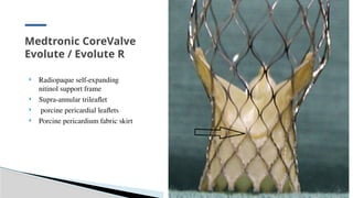 presentation Current Status Of Percutaneous Heart Valve Implantation.pptx