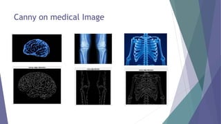 Content Based Medical Image Retrieval System | PPTX