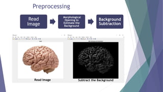 Content Based Medical Image Retrieval System | PPTX