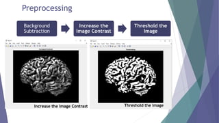 Content Based Medical Image Retrieval System | PPTX