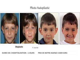 Photo Autoplastie
DUREE DE L’HOSPITALISATION : 1 JOURS PRIX DE NOTRE AGENCE 1500 EURO
 