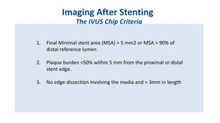Session X: “Ongoing CTO Trials” CHIP IVUS R. Diletti, Netherlands | PDF