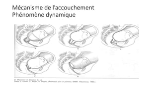 Mécanisme de l’accouchement
Phénomène dynamique
 