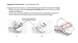 Engagement proprement dit : c’est la traversée du DS
L’engagement se fait à travers un cylindre anatomique (le cylindre de descente de Hodge)
- limité en haut par le diamètre promonto-rétro-pubien (défini comme étant le premier
parallèle de Hodge), et
- limité en bas par la ligne parallèle au diamètre promonto- rétropubien qui passe par
le bord inférieur de la symphyse pubienne (deuxième parallèle de Hodge).
 