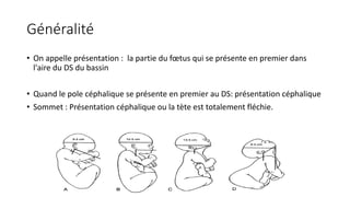 Généralité
• On appelle présentation : la partie du fœtus qui se présente en premier dans
l'aire du DS du bassin
• Quand le pole céphalique se présente en premier au DS: présentation céphalique
• Sommet : Présentation céphalique ou la tète est totalement fléchie.
 
