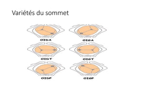 Variétés du sommet
 