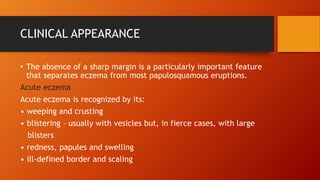 CLINICAL APPEARANCE
• The absence of a sharp margin is a particularly important feature
that separates eczema from most papulosquamous eruptions.
Acute eczema
Acute eczema is recognized by its:
• weeping and crusting
• blistering – usually with vesicles but, in fierce cases, with large
blisters
• redness, papules and swelling
• ill-defined border and scaling
 