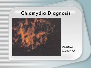 Sexually Transmitted Diseases | PPT