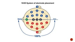 10/20 System of electrode placement
 
