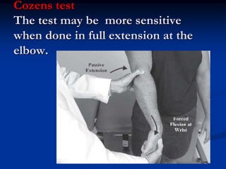 Cozens test
The test may be more sensitive
when done in full extension at the
elbow.
 