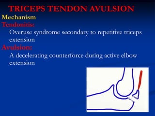 TRICEPS TENDON AVULSION
Mechanism
Tendonitis:
Overuse syndrome secondary to repetitive triceps
extension
Avulsion:
A decelerating counterforce during active elbow
extension
 