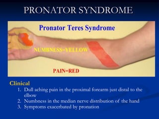 PRONATOR SYNDROME
Clinical
1. Dull aching pain in the proximal forearm just distal to the
elbow
2. Numbness in the median nerve distribution of the hand
3. Symptoms exacerbated by pronation
 