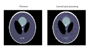 Phantom Learned post-processing
 