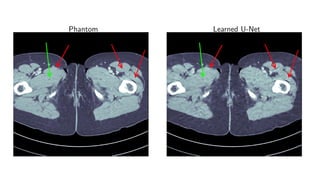 Phantom Learned U-Net
 